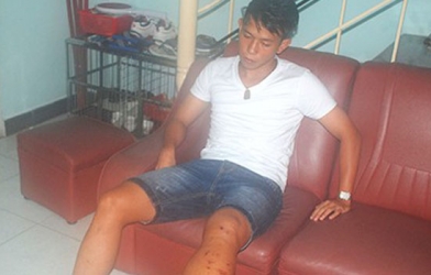 Chấn thương của Anh Khoa là cực kỳ nghiêm trọng