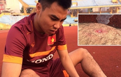 Điểm tin 12/12: Thêm ca chấn thương cho U23 Việt Nam, Bình Dương hẹn đấu Á quân Thái Lan