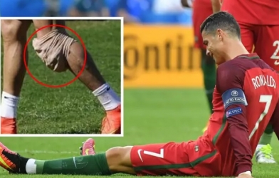 Ronaldo gặp chấn thương mãn tính 'vô phương cứu chữa'