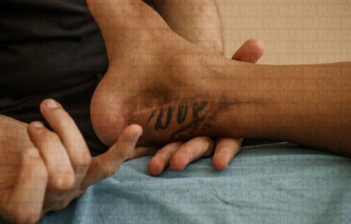 Bi kịch Cazorla: Bị cắt 8cm chân vẫn phải phẫu thuật lần 9