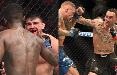 Lựa chọn nào cho Kelvin Gastelum và Max Holloway sau UFC 236