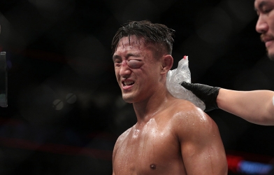 Võ sĩ Hàn Quốc gần mù mắt vì lĩnh trọn cú đấm 'tử thần' 