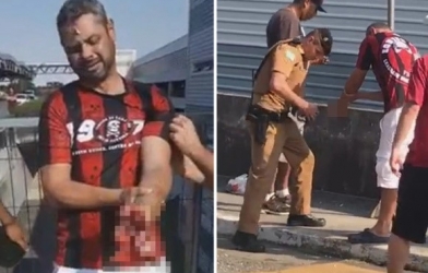 VIDEO: Kinh hoảng khoảnh khắc CĐV cụt tay vì pháo sáng 