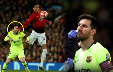 Smalling tiết lộ những gì Messi nói sau pha va chạm đổ máu