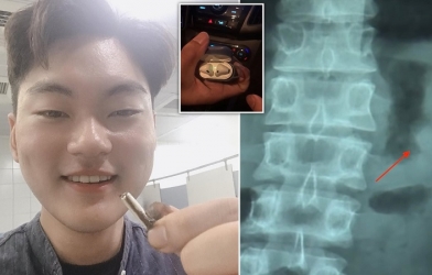 Airpod vẫn dùng tốt sau khi bị nuốt vào bụng