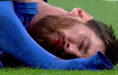 Messi gẫy răng sau pha vung cùi chỏ của Marcelo