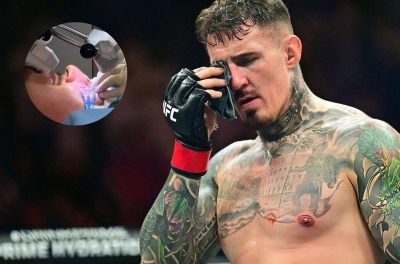 Tom Aspinall phẫu thuật mắt thành công, chưa ấn định thời điểm trở lại UFC