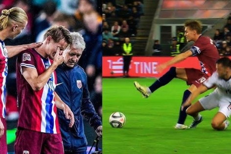 Khiến Odegaard chấn thương, cầu thủ ĐT Áo chính thức lên tiếng