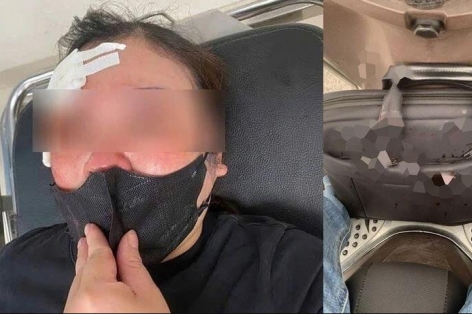 Tấn công phụ nữ giữa phố bằng dùi cui: Người đàn ông Hà Nội đối diện mức phạt ra sao?