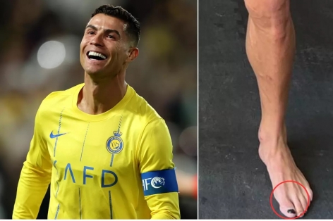 Ronaldo gây sốt vì sơn móng chân như con gái, ngủ trưa 5 lần một ngày