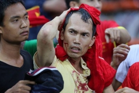 'CĐV Malaysia chỉ dùng chai nước tấn công fan Việt'