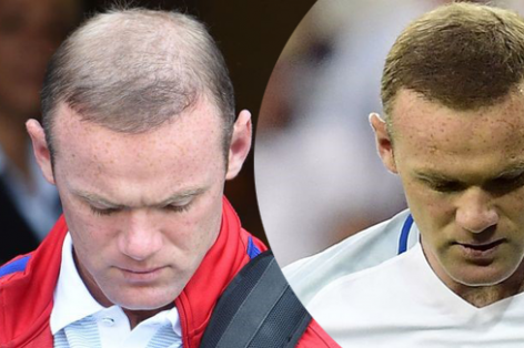 VIDEO: Rooney hói trở lại sau trận Anh thua Iceland