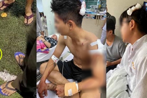 Cầu thủ phủi Việt Nam bị đánh trọng thương, phải nhập viện cấp cứu