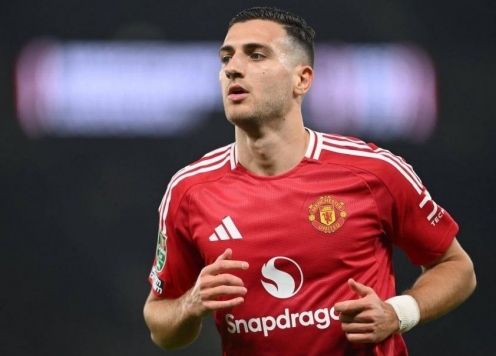 Ngôi sao MU chỉ trích lối chơi của Quỷ Đỏ