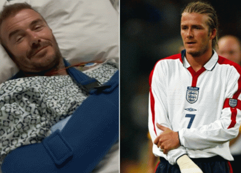 David Beckham tái xuất sau ca mổ bí mật