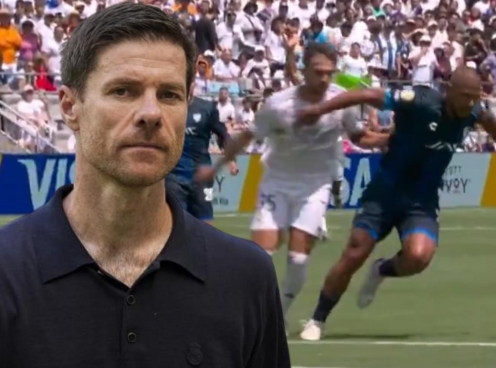 Thắng trận, Xabi Alonso bất ngờ lên tiếng chỉ trích một ngôi sao Real Madrid