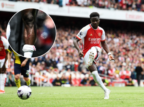 NHM Arsenal phẫn nộ với hình ảnh Saka bị kê chân và đối thủ thoát thẻ