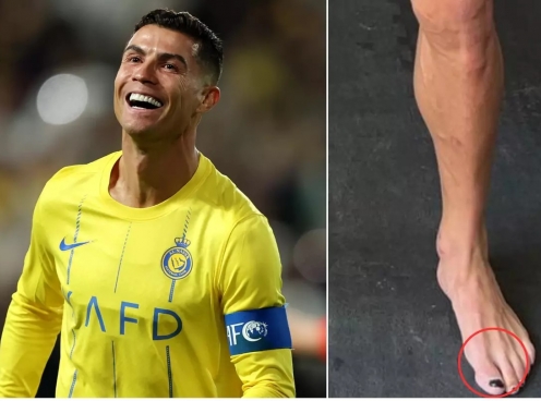 Ronaldo gây sốt vì sơn móng chân như con gái, ngủ trưa 5 lần một ngày