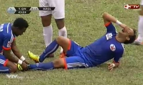 Video bóng đá: Cận cảnh chấn thương 'rùng rợn' của cầu thủ Than Quảng Ninh