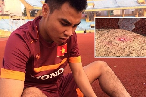 Điểm tin 12/12: Thêm ca chấn thương cho U23 Việt Nam, Bình Dương hẹn đấu Á quân Thái Lan