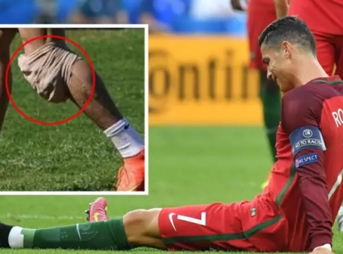 Ronaldo gặp chấn thương mãn tính 'vô phương cứu chữa'
