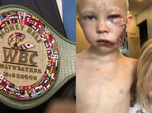 Cậu bé 6 tuổi đánh bại chó dữ cứu em nhận đai vô địch Boxing thế giới