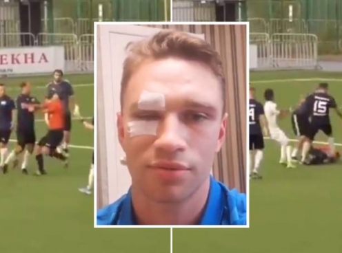 VIDEO: Cựu đội trưởng tuyển Nga đánh trọng tài nhập viện