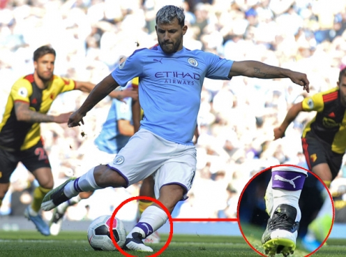 Chạy quá mạnh, Agüero phải mang giày đá bóng riêng
