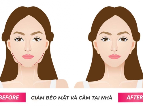 11 Cách giảm béo mặt và cằm hiệu quả ngay tại nhà