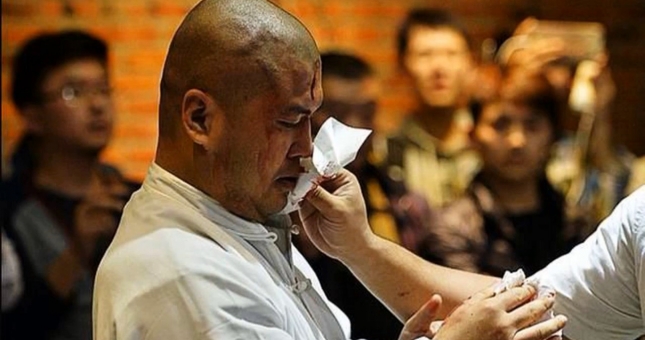 Võ sư Thái Cực Ngụy Lôi bị HLV thể dục 20 tuổi đánh nhập viện