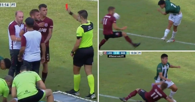 Cầu thủ Argentina nhận thẻ đỏ oái oăm vì bị đối thủ sút vào mặt