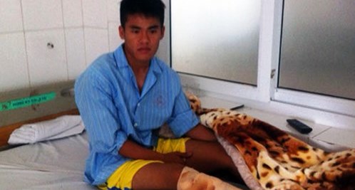 Đá gãy chân đối phương: Thủ phạm suy sụp, nạn nhân thương cảm