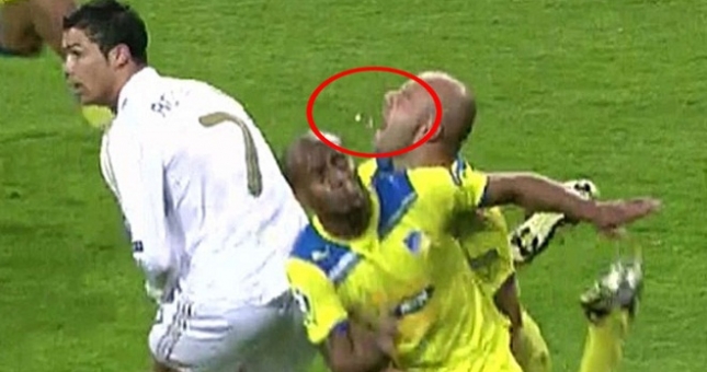 Video hài hước: Tổng hợp những pha tai nạn gẫy răng như Mikael Arteta