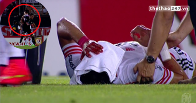 VIDEO: Pha cùi chỏ khiến đối thủ đo ván ngay trên sân