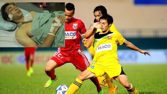 Hải Phòng tổn thất lực lượng nghiêm trọng sau trận thua SHB.Đà Nẵng