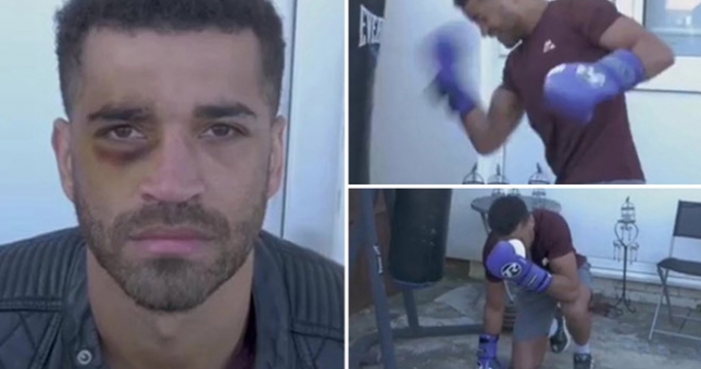 Rảnh rỗi, nhà vô địch Boxing tự đấm tím mắt chính mình