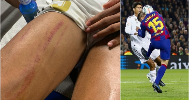Bằng chứng Varane bị trung vệ Barca 'chặt chém' tơi tả