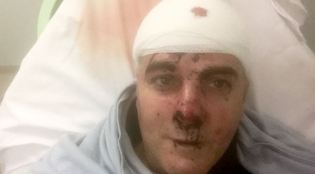 Người cha dùng MMA một mình bảo vệ con trai khỏi 5 tên cướp có vũ khí