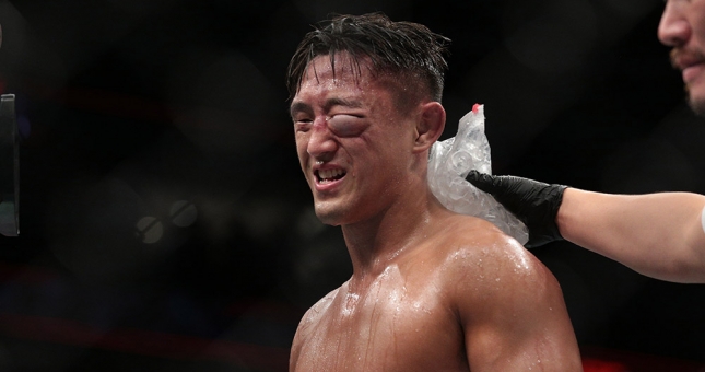 Võ sĩ Hàn Quốc gần mù mắt vì lĩnh trọn cú đấm 'tử thần' 