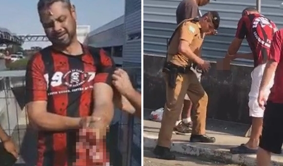 VIDEO: Kinh hoảng khoảnh khắc CĐV cụt tay vì pháo sáng 