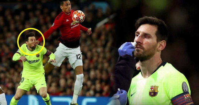 Smalling tiết lộ những gì Messi nói sau pha va chạm đổ máu