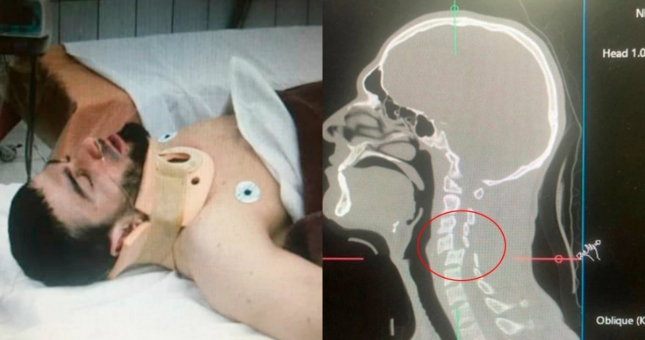 Võ sĩ Nga gãy cổ vì dính đòn của đối thủ