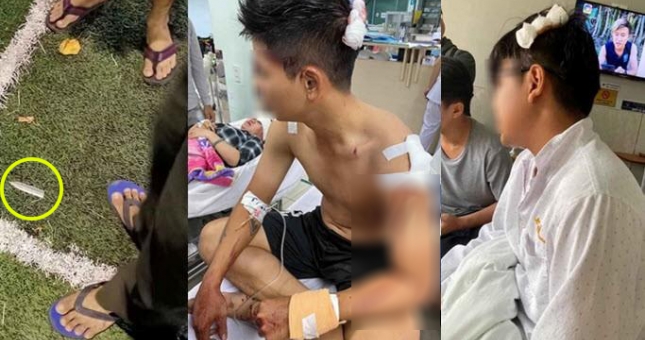 Cầu thủ phủi Việt Nam bị đánh trọng thương, phải nhập viện cấp cứu