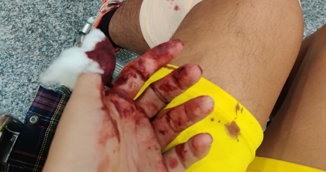 Cầu thủ phủi bị đánh trọng thương, phải nhập viện khẩn cấp?