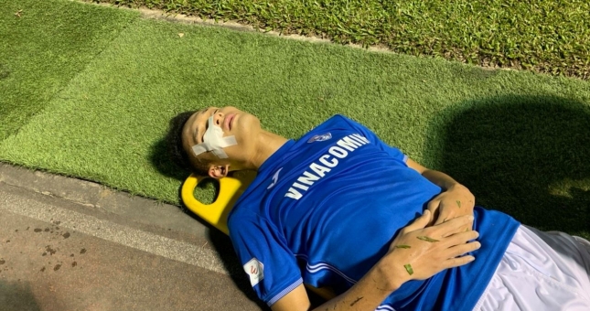 Thêm 1 cầu thủ V.League nhập viện cấp cứu, khâu 3 mũi