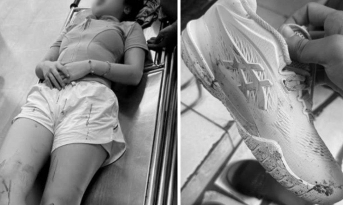 Cô gái bị ném vợt pickleball vào đầu, nhập viện trong đêm