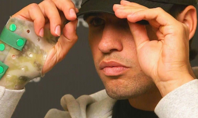 Alcaraz nguy cơ nghỉ thi đấu lâu hơn dự kiến