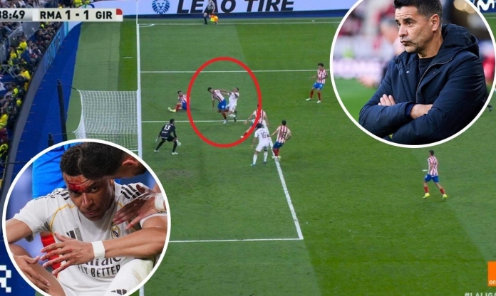 Mbappe đổ gục, phía Girona lên tiếng khiến Real nóng mặt