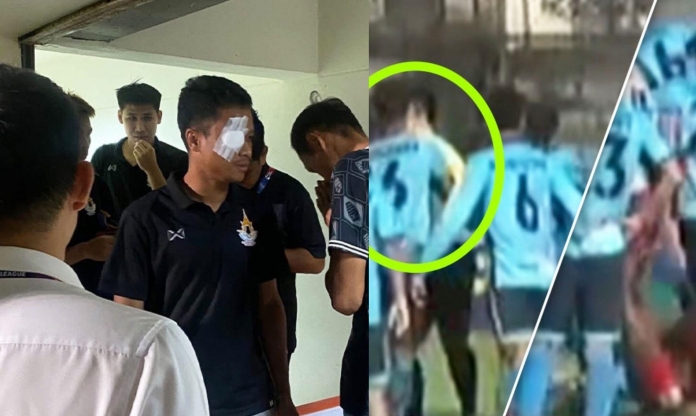 Cầu thủ Thái Lan đấm trọng tài và đối thủ sưng mắt