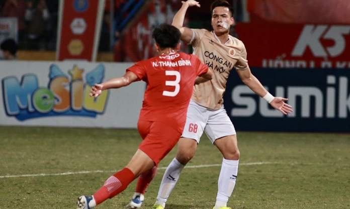 Bùi Hoàng Việt Anh báo tin đến HLV Troussier về vết khâu 24 mũi